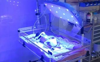 Phototherapy in sud hospital in Jalandhar phototherapy